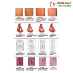 كريم لعلاج دوالى الساقين